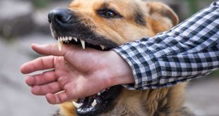 Things You Need To Do After Getting Injured By A Dog